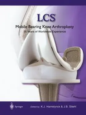 Hamelynck / Stiehl |  LCS® Mobile Bearing Knee Arthroplasty | eBook | Sack Fachmedien