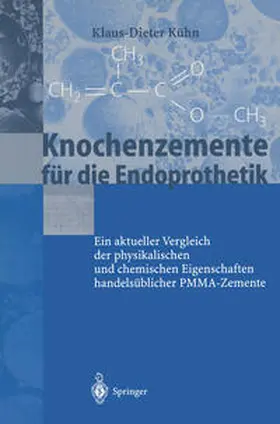 Kühn |  Knochenzemente für die Endoprothetik | eBook | Sack Fachmedien