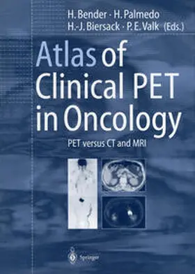 Bender / Palmedo / Biersack |  Atlas of Clinical PET in Oncology | eBook | Sack Fachmedien