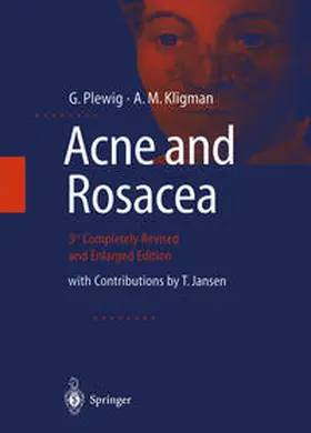 Plewig / Kligman |  ACNE and ROSACEA | eBook | Sack Fachmedien