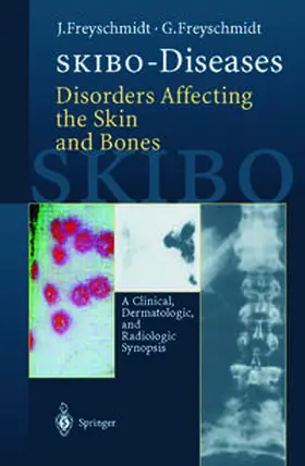 Freyschmidt |  SKIBO-Diseases Disorders Affecting the Skin and Bones | eBook | Sack Fachmedien