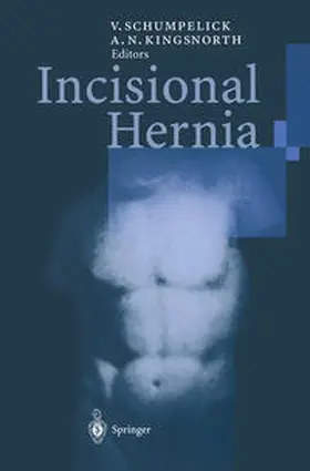 Schumpelick / Kingsnorth |  Incisional Hernia | eBook | Sack Fachmedien