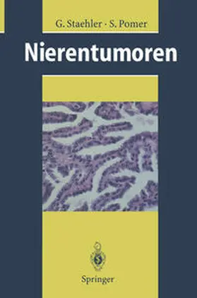 Staehler / Pomer |  Nierentumoren | eBook | Sack Fachmedien