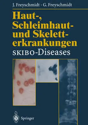 Freyschmidt |  Haut-, Schleimhaut- und Skeletterkrankungen SKIBO-Diseases | eBook | Sack Fachmedien