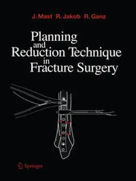 Mast / Jakob / Ganz |  Planning and Reduction Technique in Fracture Surgery | eBook | Sack Fachmedien