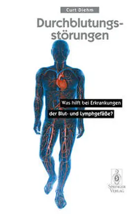 Diehm | Durchblutungsstörungen | E-Book | www.sack.de