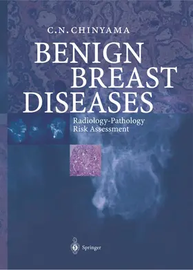 Chinyama | Benign Breast Diseases | Buch | 978-3-642-62146-8 | www.sack.de