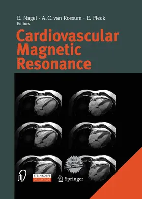 Nagel / Rossum / Fleck |  Cardiovascular Magnetic Resonance | Buch |  Sack Fachmedien