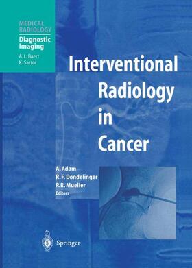 Adam / Mueller / Dondelinger | Interventional Radiology in Cancer | Buch | 978-3-642-62235-9 | sack.de