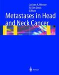 Davis / Werner |  Metastases in Head and Neck Cancer | Buch |  Sack Fachmedien
