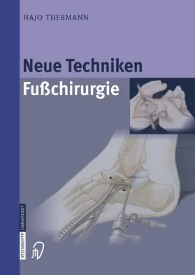 Thermann | Neue Techniken Fusschirurgie | Buch | 978-3-642-62280-9 | www.sack.de