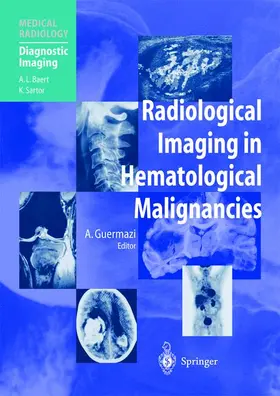 Guermazi |  Radiological Imaging in Hematological Malignancies | Buch |  Sack Fachmedien
