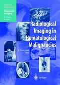 Guermazi |  Radiological Imaging in Hematological Malignancies | Buch |  Sack Fachmedien