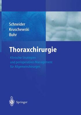 Schneider / Buhr / Kruschewski | Thoraxchirurgie | Buch | 978-3-642-62358-5 | sack.de