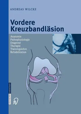 Wilcke | Vordere Kreuzbandläsion | Buch | 978-3-642-62379-0 | www.sack.de