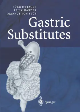 Metzger / Harder / Flüe |  Gastric Substitutes | Buch |  Sack Fachmedien