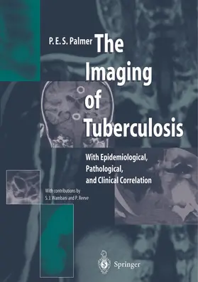Palmer |  The Imaging of Tuberculosis | Buch |  Sack Fachmedien