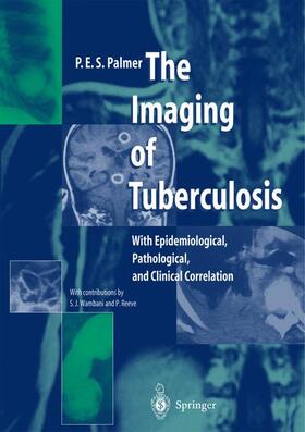 Palmer | The Imaging of Tuberculosis | Buch | 978-3-642-62610-4 | sack.de