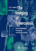 Palmer |  The Imaging of Tuberculosis | Buch |  Sack Fachmedien
