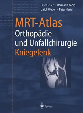 Teller / König / Weber |  MRT-Atlas Orthopädie und Unfallchirurgie | Buch |  Sack Fachmedien