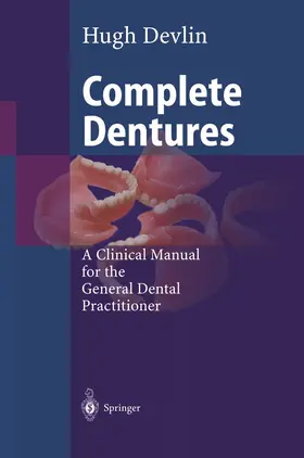 Devlin |  Complete Dentures | Buch |  Sack Fachmedien