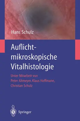 Schulz |  Auflichtmikroskopische Vitalhistologie | Buch |  Sack Fachmedien