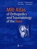Teller / König / Hertel |  MRI Atlas of Orthopedics and Traumatology of the Knee | Buch |  Sack Fachmedien
