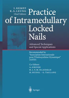 Kempf / Leung |  Practice of Intramedullary Locked Nails | Buch |  Sack Fachmedien