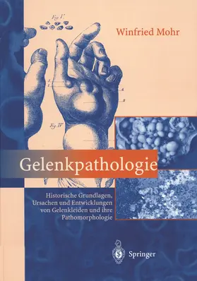 Mohr |  Gelenkpathologie | Buch |  Sack Fachmedien