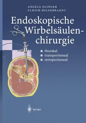 Olinger / Hildebrandt |  Endoskopische Wirbelsäulenchirurgie | Buch |  Sack Fachmedien