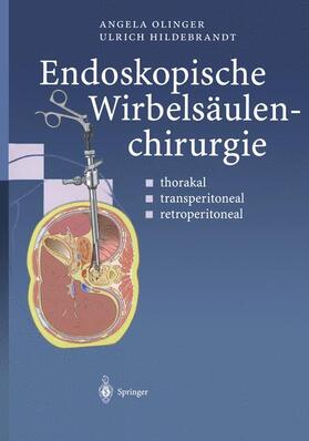 Olinger / Hildebrandt | Endoskopische Wirbelsäulenchirurgie | Buch | 978-3-642-63058-3 | sack.de