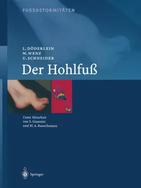 Döderlein / Wenz / Schneider | Fussdeformitäten | Buch | 978-3-642-63099-6 | www.sack.de