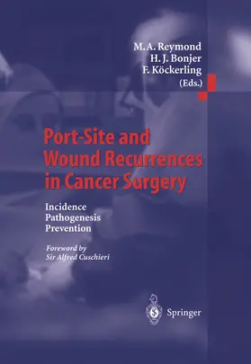 Reymond / Bonjer / Köckerling |  Port-Site and Wound Recurrences in Cancer Surgery | Buch |  Sack Fachmedien