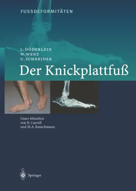 Wenz / Döderlein / Schneider | FussdeformitÄten | Buch | 978-3-642-63157-3 | www.sack.de