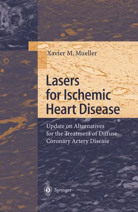 Mueller |  Lasers for Ischemic Heart Disease | Buch |  Sack Fachmedien