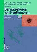 Blum / Kreusch / Bauer |  Dermatoskopie von Hauttumoren | Buch |  Sack Fachmedien