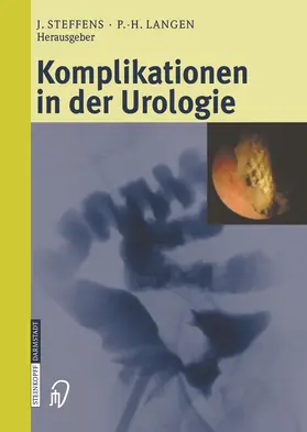 Steffens / Langen |  Komplikationen in der Urologie | Buch |  Sack Fachmedien