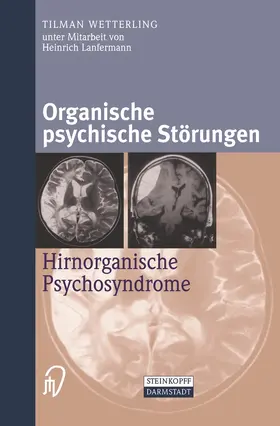 Wetterling |  Organische psychische Störungen | Buch |  Sack Fachmedien