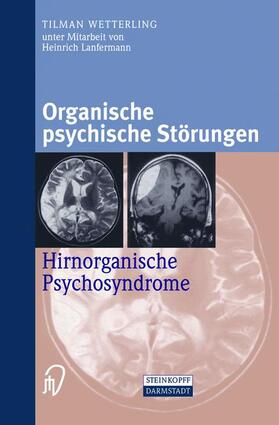 Wetterling | Organische psychische Störungen | Buch | 978-3-642-63288-4 | sack.de