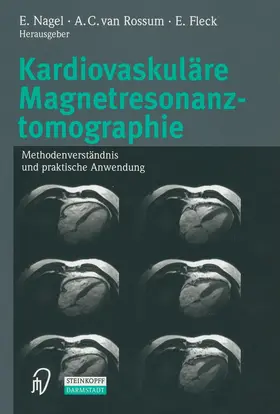 Nagel / Rossum / Fleck |  Kardiovaskuläre Magnetresonanztomographie | Buch |  Sack Fachmedien