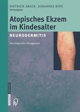 Abeck / Ring |  Atopisches Ekzem im Kindesalter (Neurodermitis) | Buch |  Sack Fachmedien