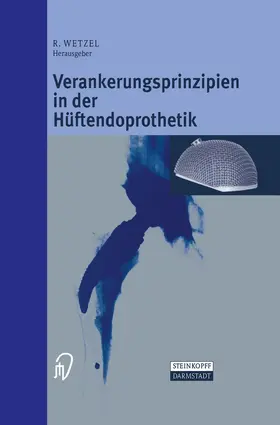 Wetzel |  Verankerungsprinzipien in der Hüftendoprothetik | Buch |  Sack Fachmedien