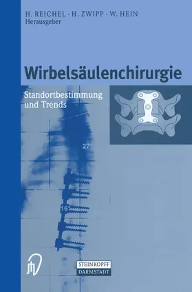Reichel / Zwipp / Hein |  Wirbelsäulenchirurgie | Buch |  Sack Fachmedien