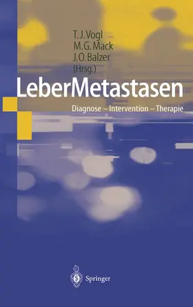 Vogl / Mack / Balzer | LeberMetastasen | Buch | 978-3-642-63958-6 | www.sack.de