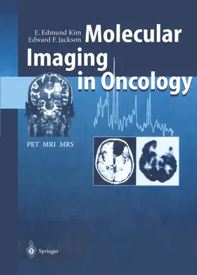 Kim / Jackson |  Molecular Imaging in Oncology | Buch |  Sack Fachmedien