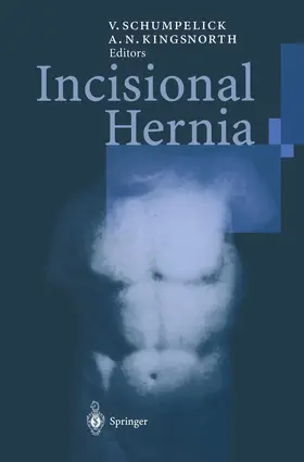 Schumpelick / Kingsnorth |  Incisional Hernia | Buch |  Sack Fachmedien