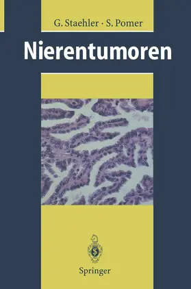 Staehler / Pomer |  Nierentumoren | Buch |  Sack Fachmedien