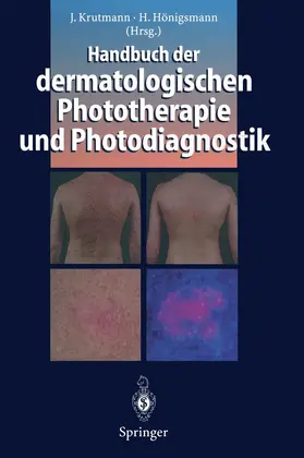 Hönigsmann / Krutmann |  Handbuch der dermatologischen Phototherapie und Photodiagnostik | Buch |  Sack Fachmedien