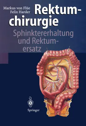 Harder / Flüe |  Rektumchirurgie | Buch |  Sack Fachmedien