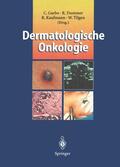 Garbe / Tilgen / Dummer |  Dermatologische Onkologie | Buch |  Sack Fachmedien